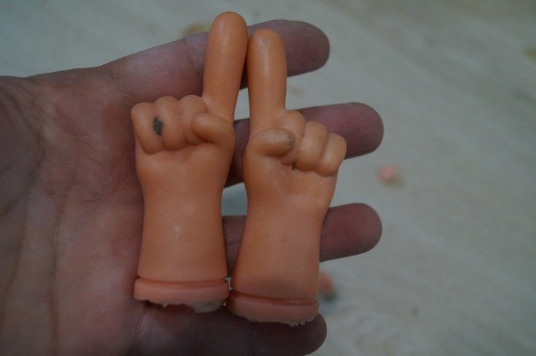 Субботняя выписка! У нейрохирурга снова была пациентка