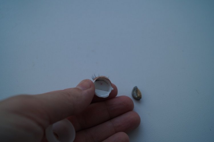 Вторая выписка января. Фарфоровая Снегурочка стала как новенькая. Зайчик снова видит. Как исправить западающий глазик у