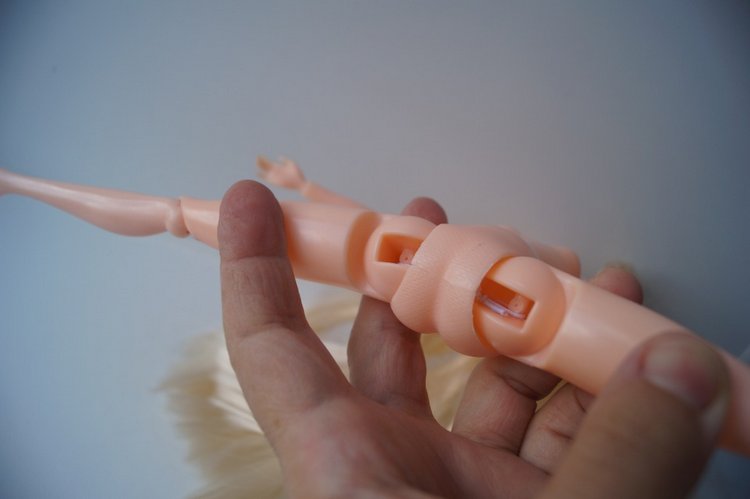 Вторая выписка сентября. Ещё одна поломка тазобедренных суставов и как её легко исправить