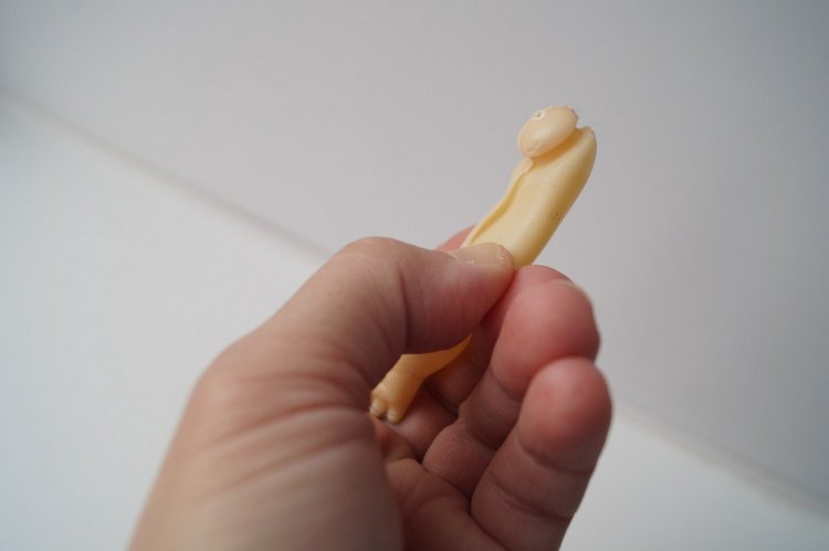 Третья выписка ноября. Лечим перелом колена, ставим донорские ручки. Анжелочка выздоровела + история-воспоминание о детском