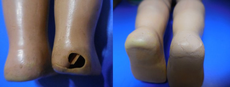 Моя реставрация K & W - König & Wernicke | Бэйбики Моя реставрация K & W - König & Wernicke