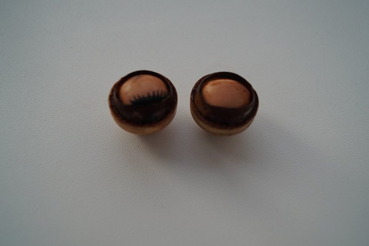 Субботняя выписка! У нейрохирурга снова была пациентка