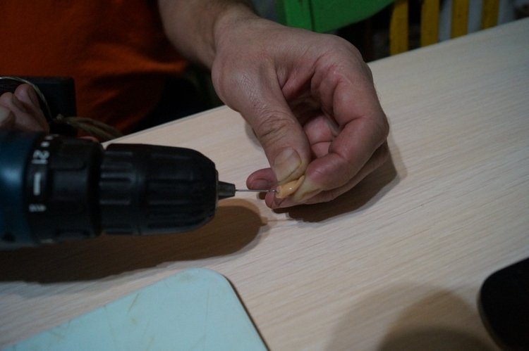 Вторая выписка декабря. Главная героиня нового года поправила своё здоровье. Лечим покусанные руки Барби, удаляем жир с