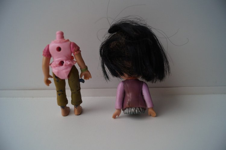 Вторая выписка декабря. Главная героиня нового года поправила своё здоровье. Лечим покусанные руки Барби, удаляем жир с