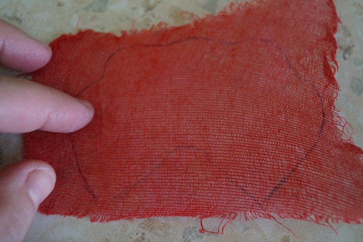 Четвёртая мартовская выписка. Машенька снова бегает и поёт! А перелом ноги исправлен за 10 минут