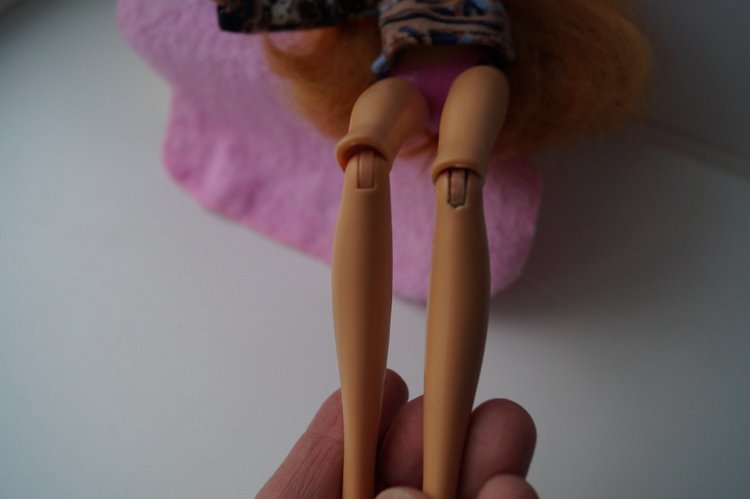 Третья выписка ноября. Лечим перелом колена, ставим донорские ручки. Анжелочка выздоровела + история-воспоминание о детском