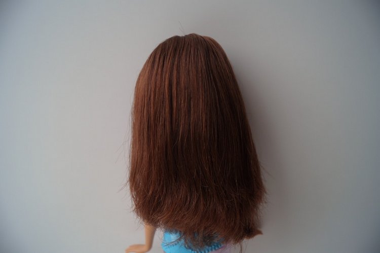 Вторая выписка декабря. Главная героиня нового года поправила своё здоровье. Лечим покусанные руки Барби, удаляем жир с