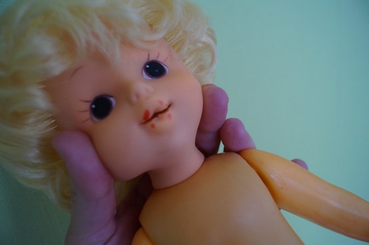 Четвёртая мартовская выписка. Машенька снова бегает и поёт! А перелом ноги исправлен за 10 минут