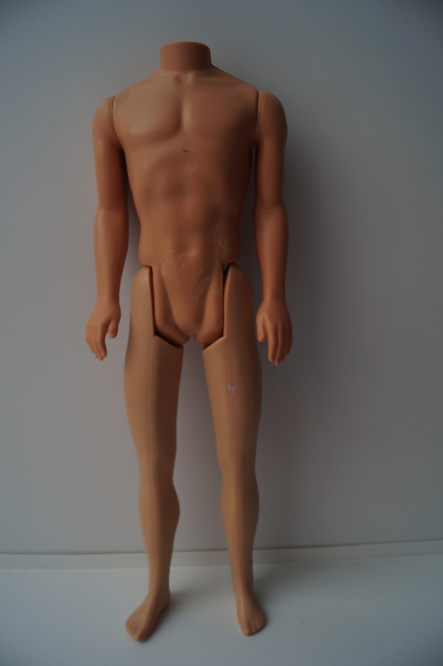 Третья мартовская выписка. Вылечено два перелома