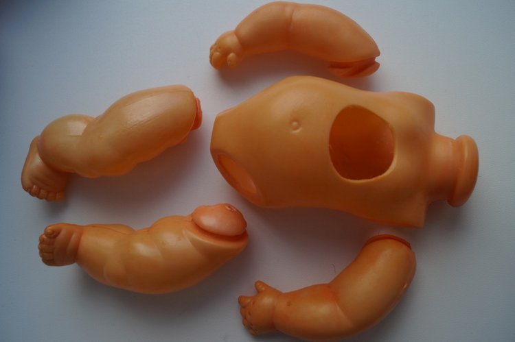 Четвёртая мартовская выписка. Машенька снова бегает и поёт! А перелом ноги исправлен за 10 минут