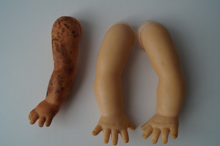 Третья выписка сентября. Перелом колена, сломано крепление руки в плече, сгрызена кисть или полное её отсутствие - это все