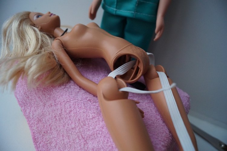 Четвёртая выписка декабря. Лечение тазобедренных суставов Барби. Четверо новогодних героев поправили своё здоровье.