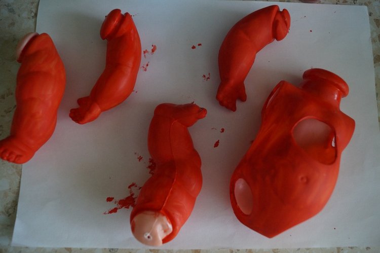 Четвёртая мартовская выписка. Машенька снова бегает и поёт! А перелом ноги исправлен за 10 минут