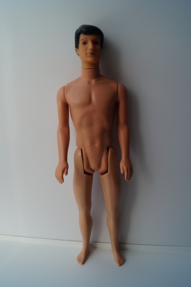 Третья мартовская выписка. Вылечено два перелома