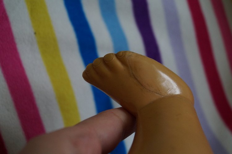 Лечение куколок, продолжение