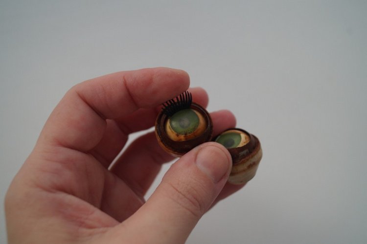 Субботняя выписка! У нейрохирурга снова была пациентка