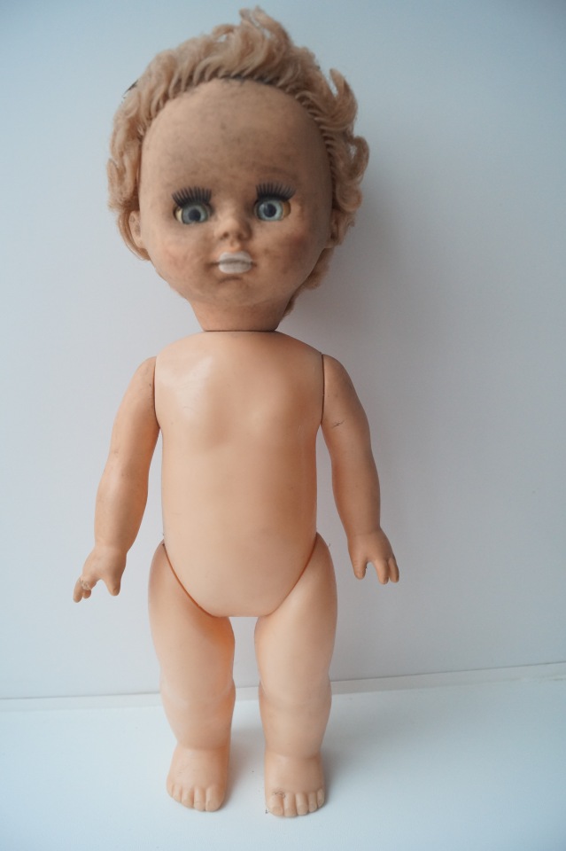 Третья выписка ноября. Лечим перелом колена, ставим донорские ручки. Анжелочка выздоровела + история-воспоминание о детском