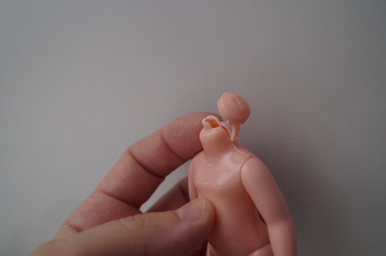 Третья выписка февраля. Сложная пациентка получила помощь нейрохирурга, бегемот Тотоша снова ловит шарики, лепка стоп +