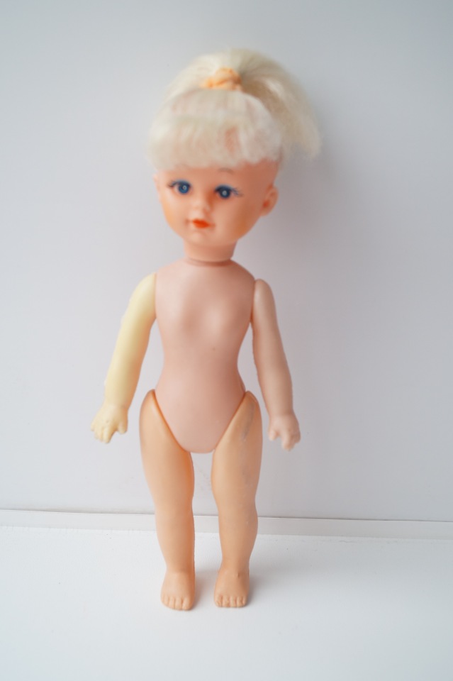 Третья выписка ноября. Лечим перелом колена, ставим донорские ручки. Анжелочка выздоровела + история-воспоминание о детском