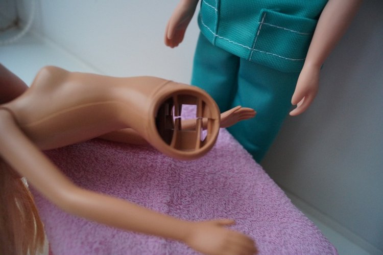 Четвёртая выписка декабря. Лечение тазобедренных суставов Барби. Четверо новогодних героев поправили своё здоровье.