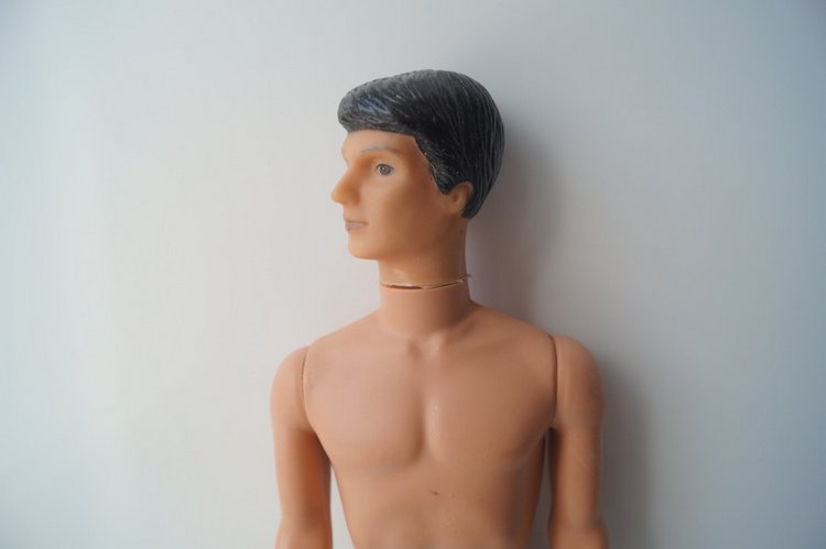 Третья мартовская выписка. Вылечено два перелома