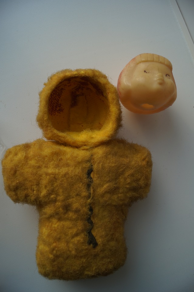 Третья мартовская выписка. Вылечено два перелома