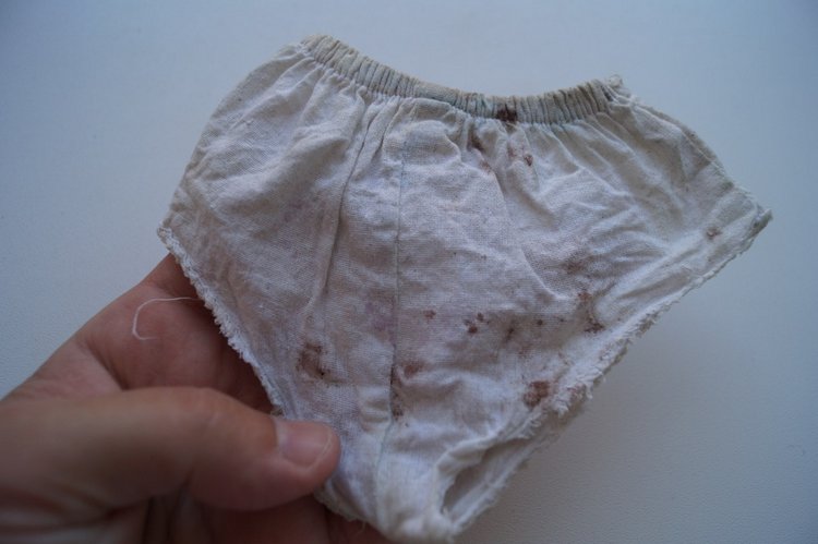 Вторая выписка августа. Потеря пальчика, ноги или стоп - это не беда, можно слепить. Кукла безнадёга стала красавицей | Бэйбики Вторая выписка августа. Потеря пальчика, ноги или стоп - это не беда, можно слепить. Кукла безнадёга стала красавицей