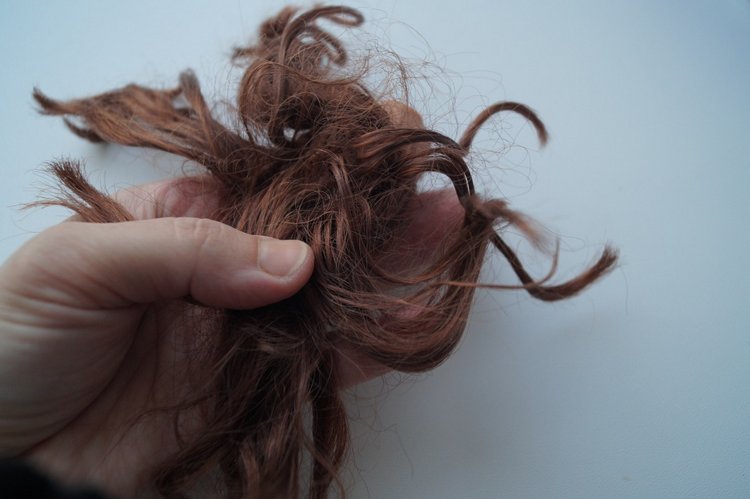 Вторая выписка декабря. Главная героиня нового года поправила своё здоровье. Лечим покусанные руки Барби, удаляем жир с