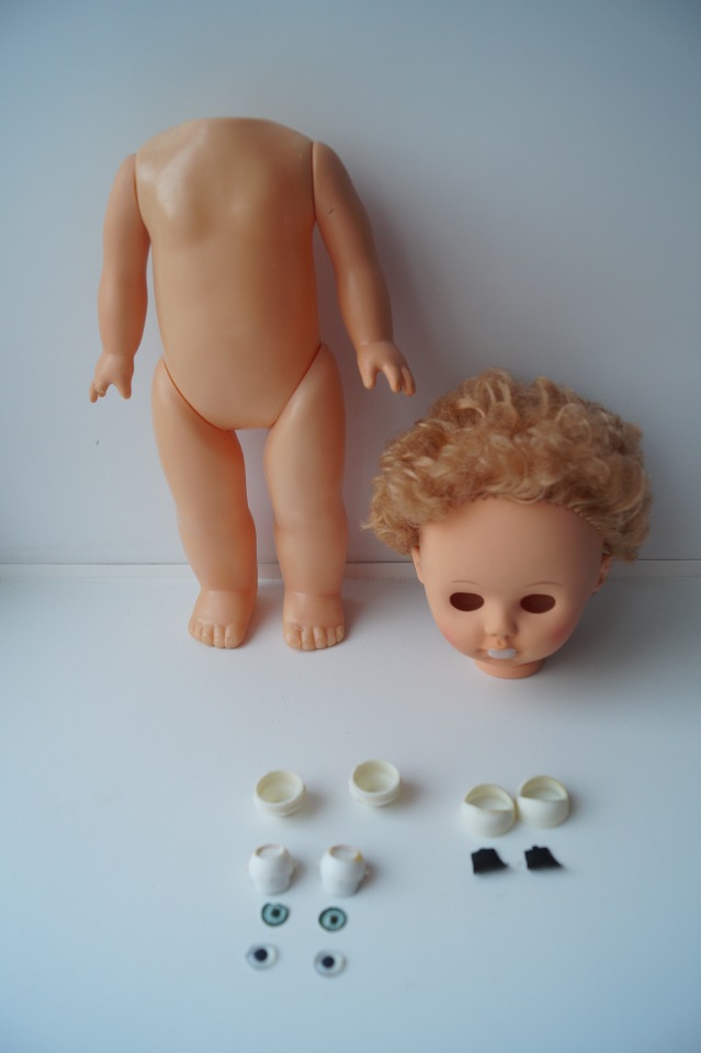 Третья выписка ноября. Лечим перелом колена, ставим донорские ручки. Анжелочка выздоровела + история-воспоминание о детском