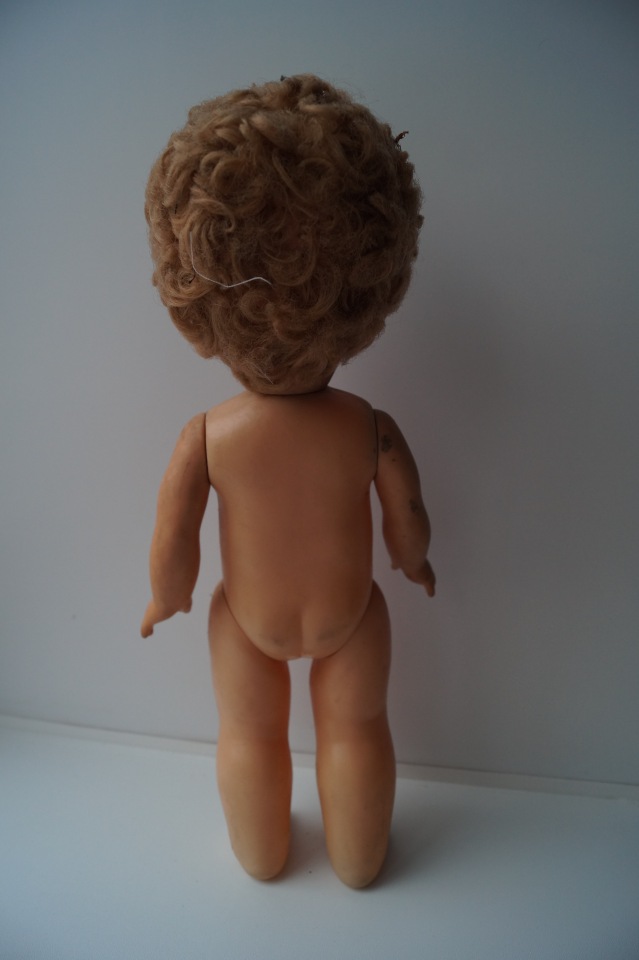 Третья выписка ноября. Лечим перелом колена, ставим донорские ручки. Анжелочка выздоровела + история-воспоминание о детском