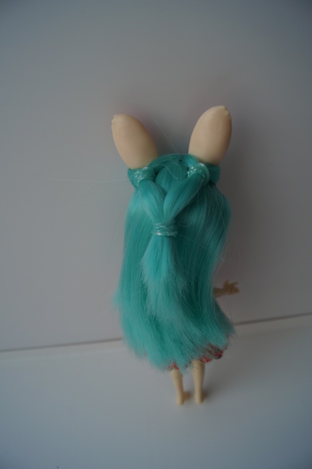 Третья мартовская выписка. Вылечено два перелома