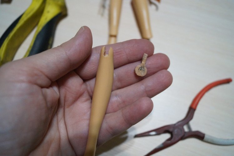 Третья выписка ноября. Лечим перелом колена, ставим донорские ручки. Анжелочка выздоровела + история-воспоминание о детском