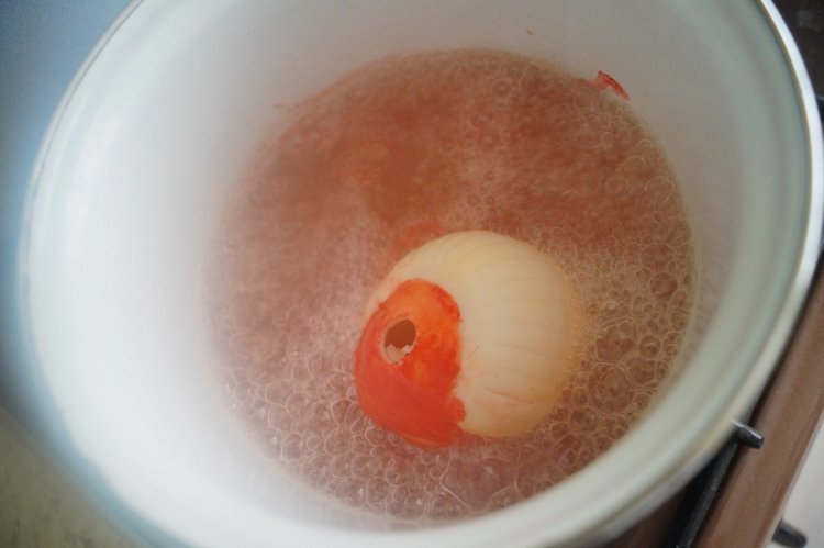 Третья мартовская выписка. Вылечено два перелома