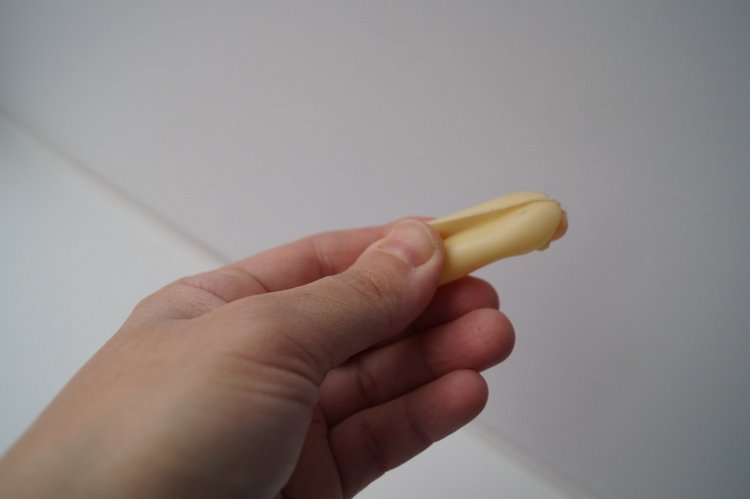 Третья выписка ноября. Лечим перелом колена, ставим донорские ручки. Анжелочка выздоровела + история-воспоминание о детском