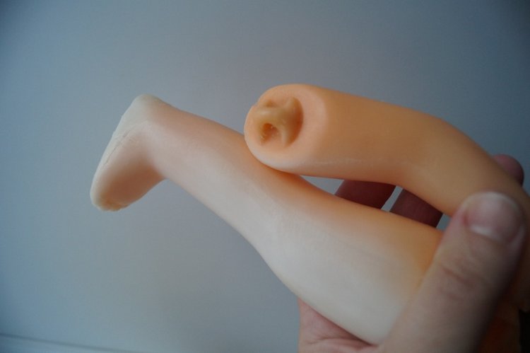 Четвёртая мартовская выписка. Машенька снова бегает и поёт! А перелом ноги исправлен за 10 минут (фото 4)