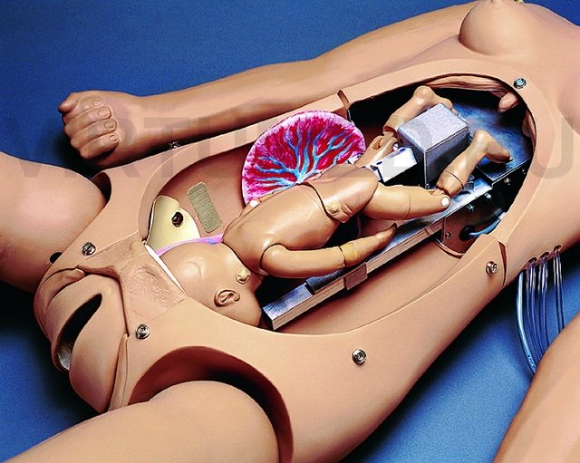 На каждого Бармалея свой Айболит или Куклы Гиппократа. От старинных диагностических кукол до современных медицинских