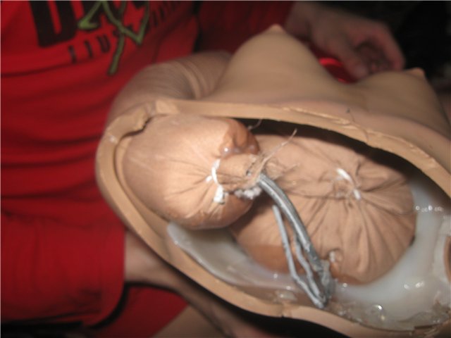 Как лечилась моя Кассандра. Реставрация куклы (фото 3)