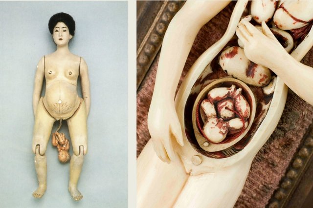 На каждого Бармалея свой Айболит или Куклы Гиппократа. От старинных диагностических кукол до современных медицинских