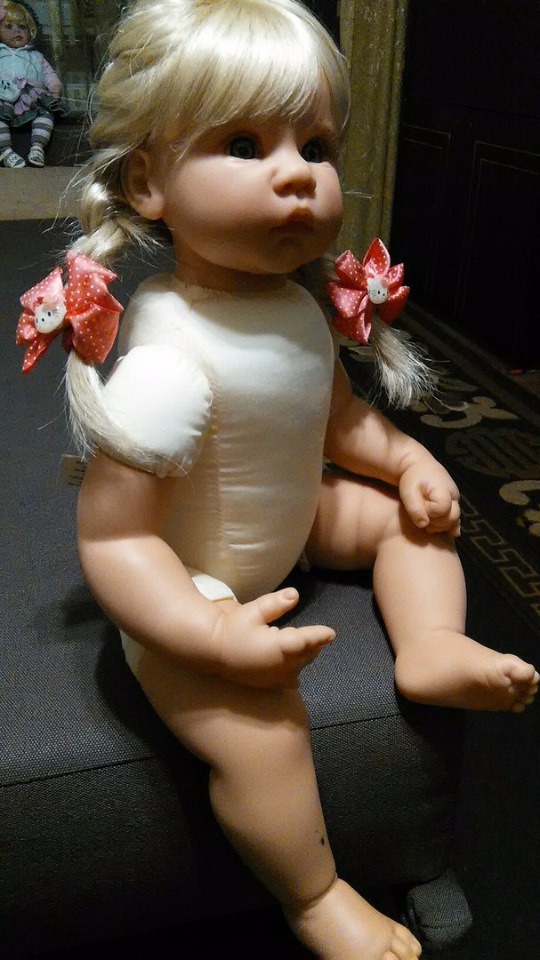 Первая Ли Миддлтошка: помогите вылечить малышку (фото 3)