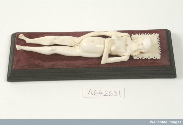 На каждого Бармалея свой Айболит или Куклы Гиппократа. От старинных диагностических кукол до современных медицинских