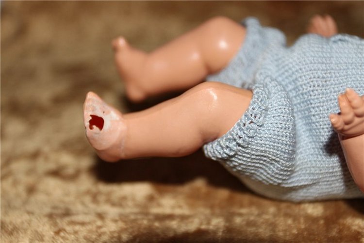 Полечим! Целлулоидный лак