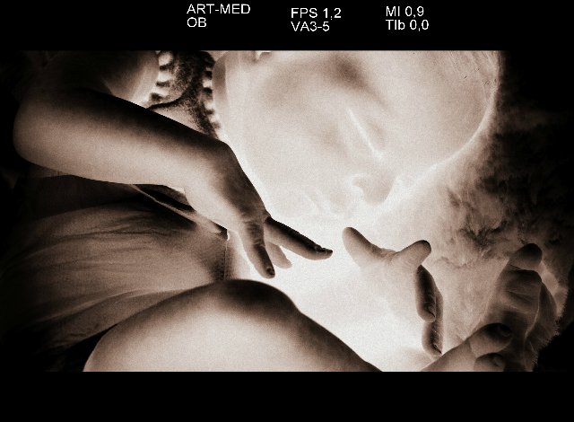 Спящая малышка Рози 2. Куколка реборн Виктории Вишни (фото 3)