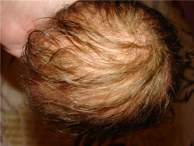 Филипок. Мой переделанный малыш беренжер