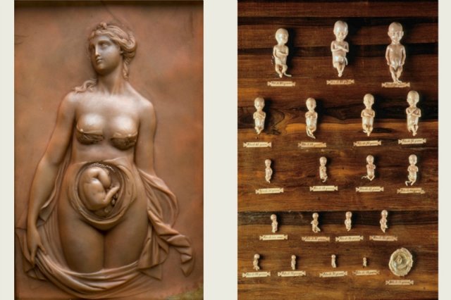 На каждого Бармалея свой Айболит или Куклы Гиппократа. От старинных диагностических кукол до современных медицинских