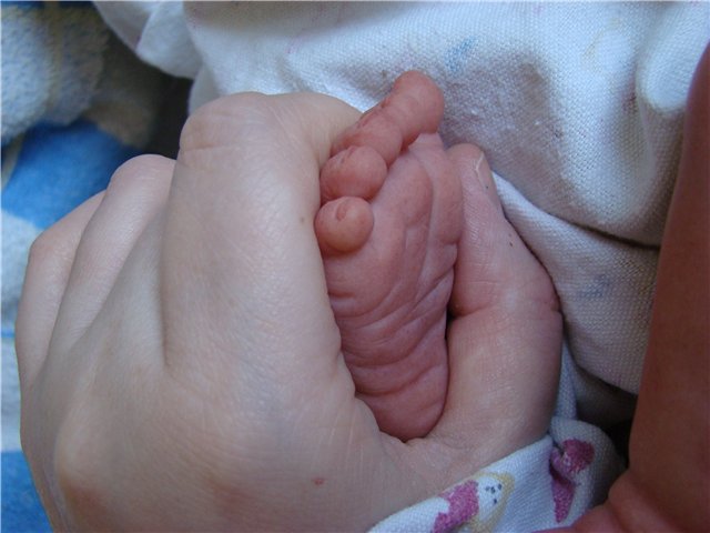 Филипок. Мой переделанный малыш беренжер (фото 5)