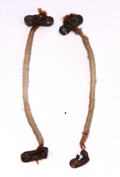 Целлулоидный пупс. Возвращение к жизни (фото 4)