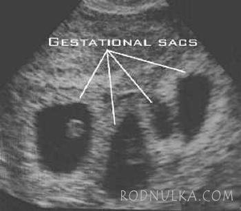 "Но как же вы могли так раздвоиться? Две половинки яблока различней." Близнецы от Кристин Оранж