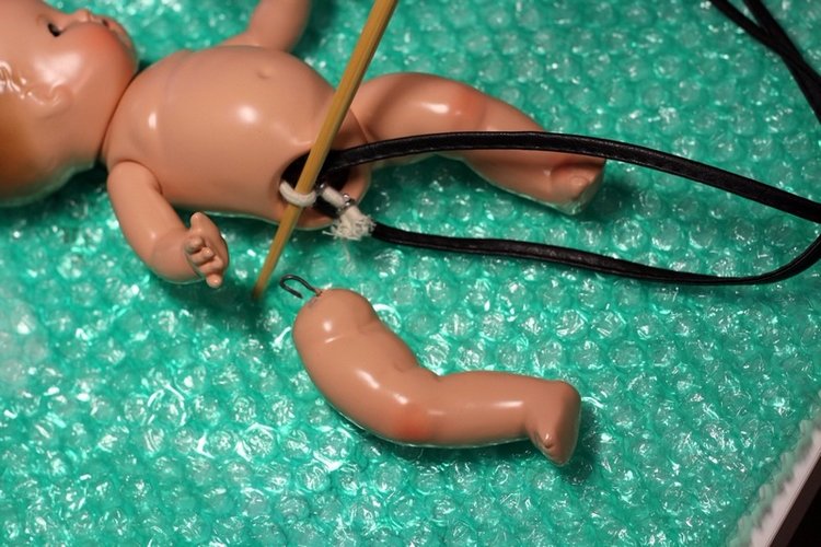 Вставляем глазки малышу Patsy Babyette от Effanbee (фото 2)