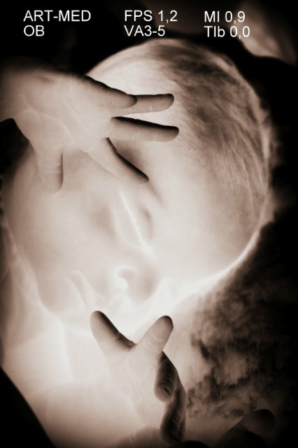 Спящая малышка Рози 2. Куколка реборн Виктории Вишни (фото 5)