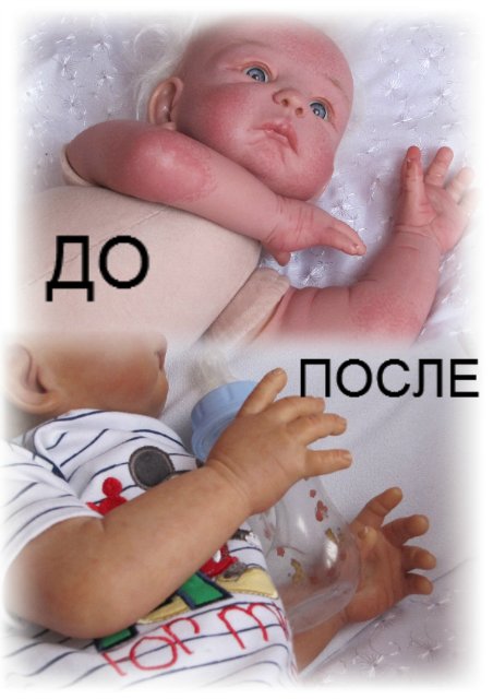 История с хорошим концом. Перерождение малыша Сенди (фото 4)